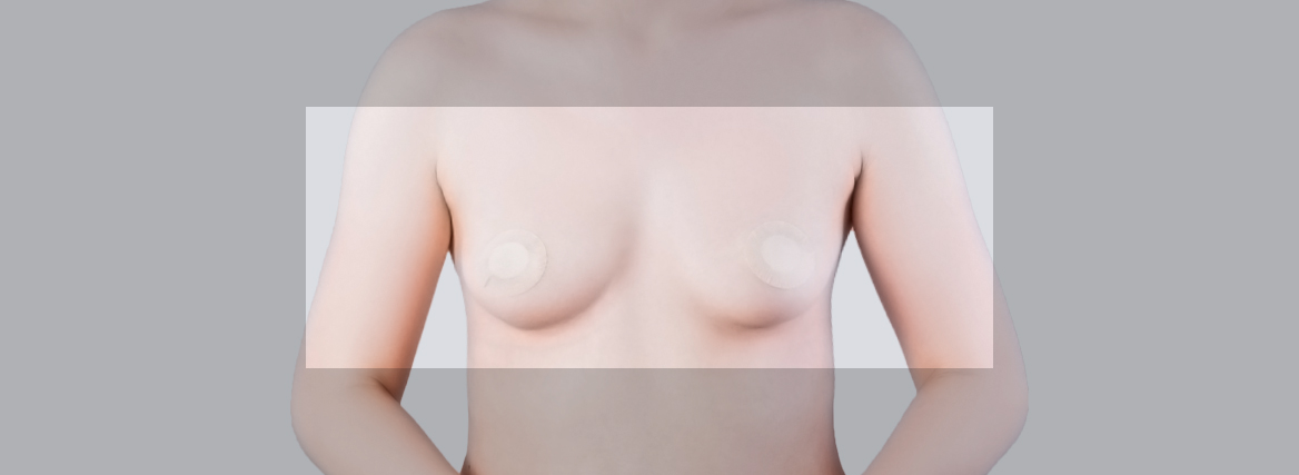 °¡½¿È®´ë-°Å»ó¼ú