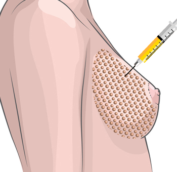 ������ ����2