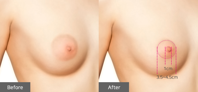 �������Ļ���