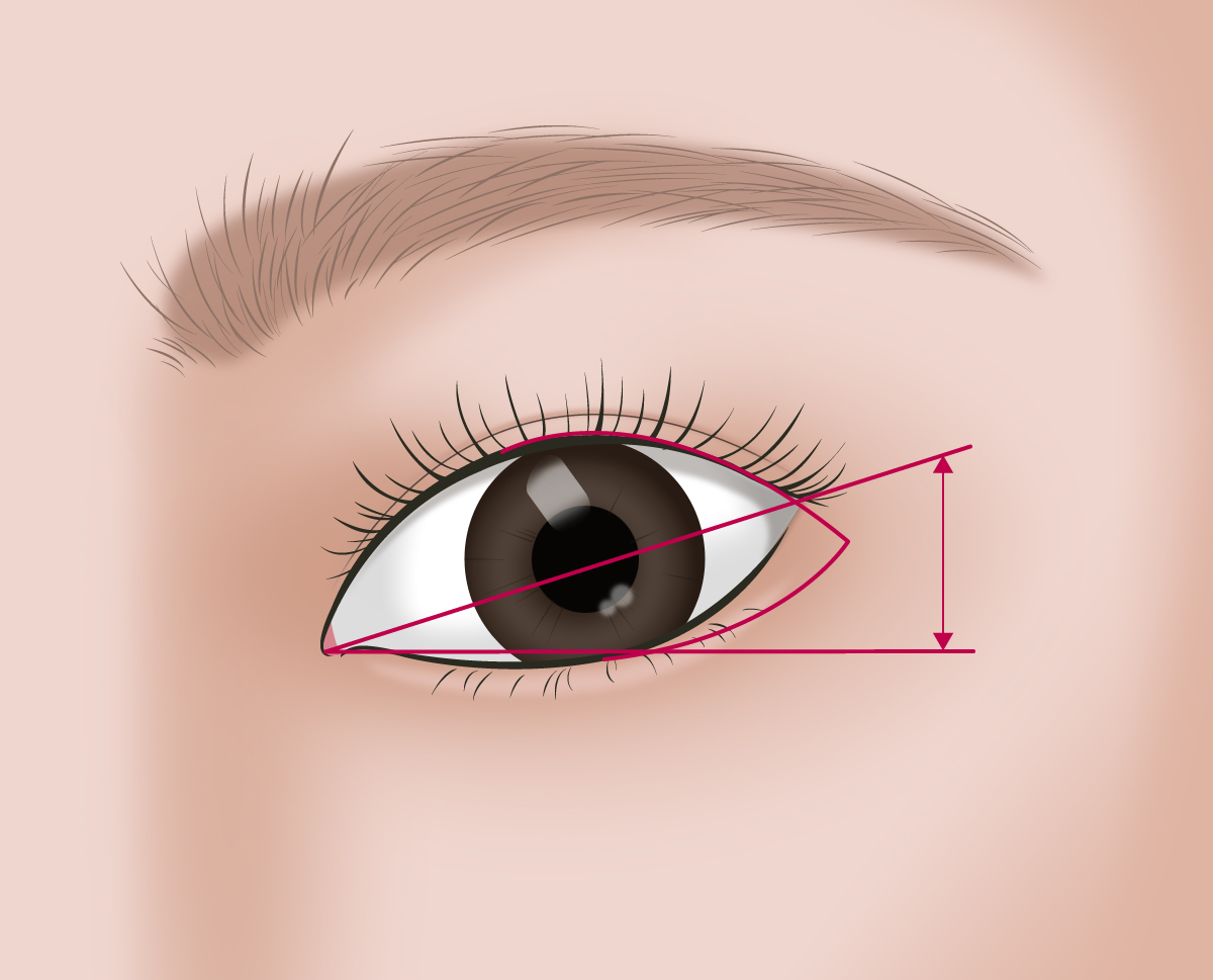 �������� ����  �ö� ��