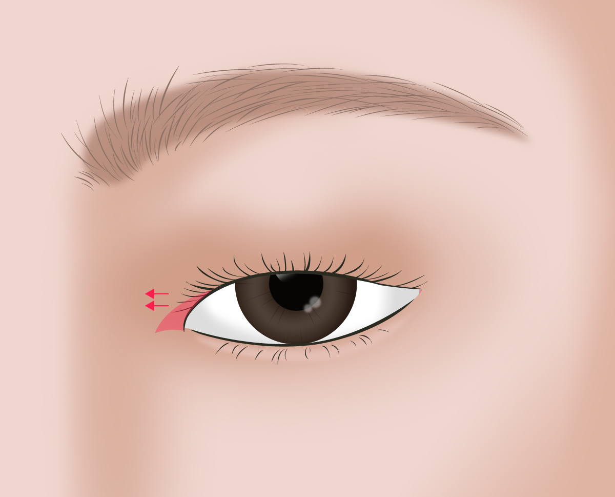 �����ָ��� ����