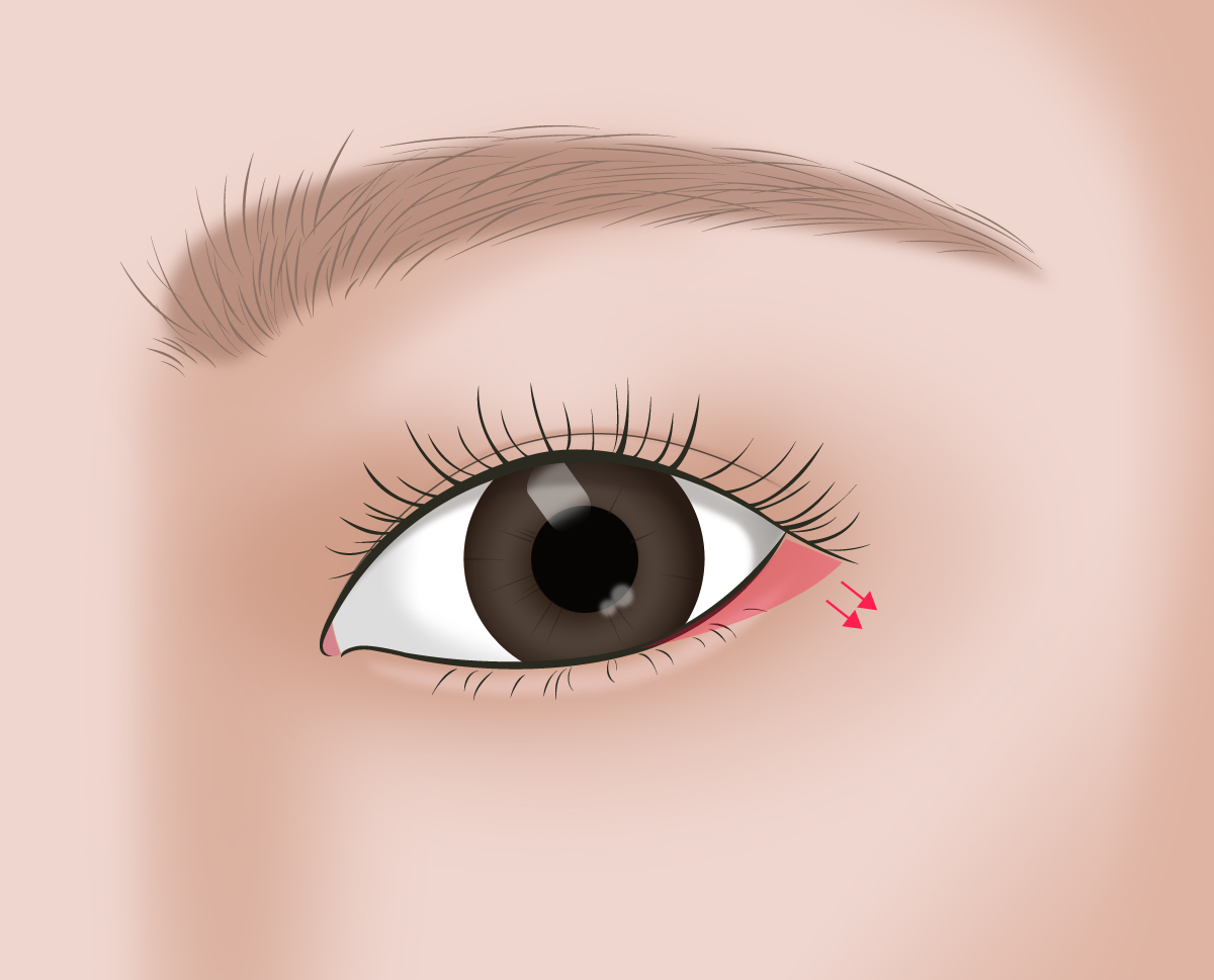 ������ �Ʒ��� �ḷ�� �̼��ϰ� ���� �� �ڿ������� ������ �Ʒ��� ��� �ܴ��� ����