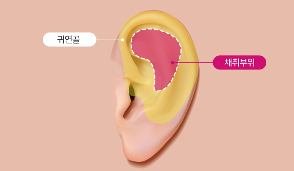 �� ���� ä�����