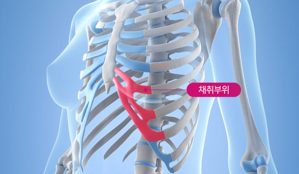 ������ ä�����