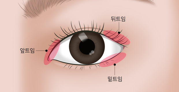 Ʈ Ʈ Ʈ ġ ϴ 